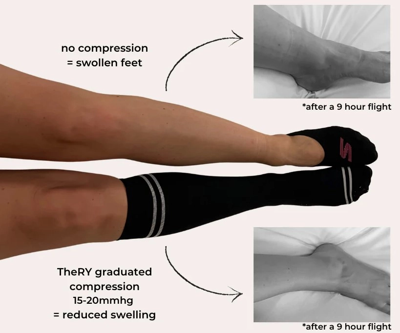 How Compression Socks Are Redefining Style and Function?